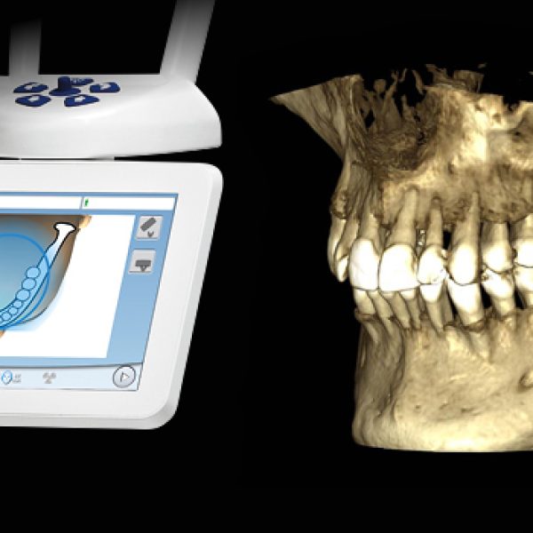 extended-volume-size-for-planmeca-promax-3d-classic